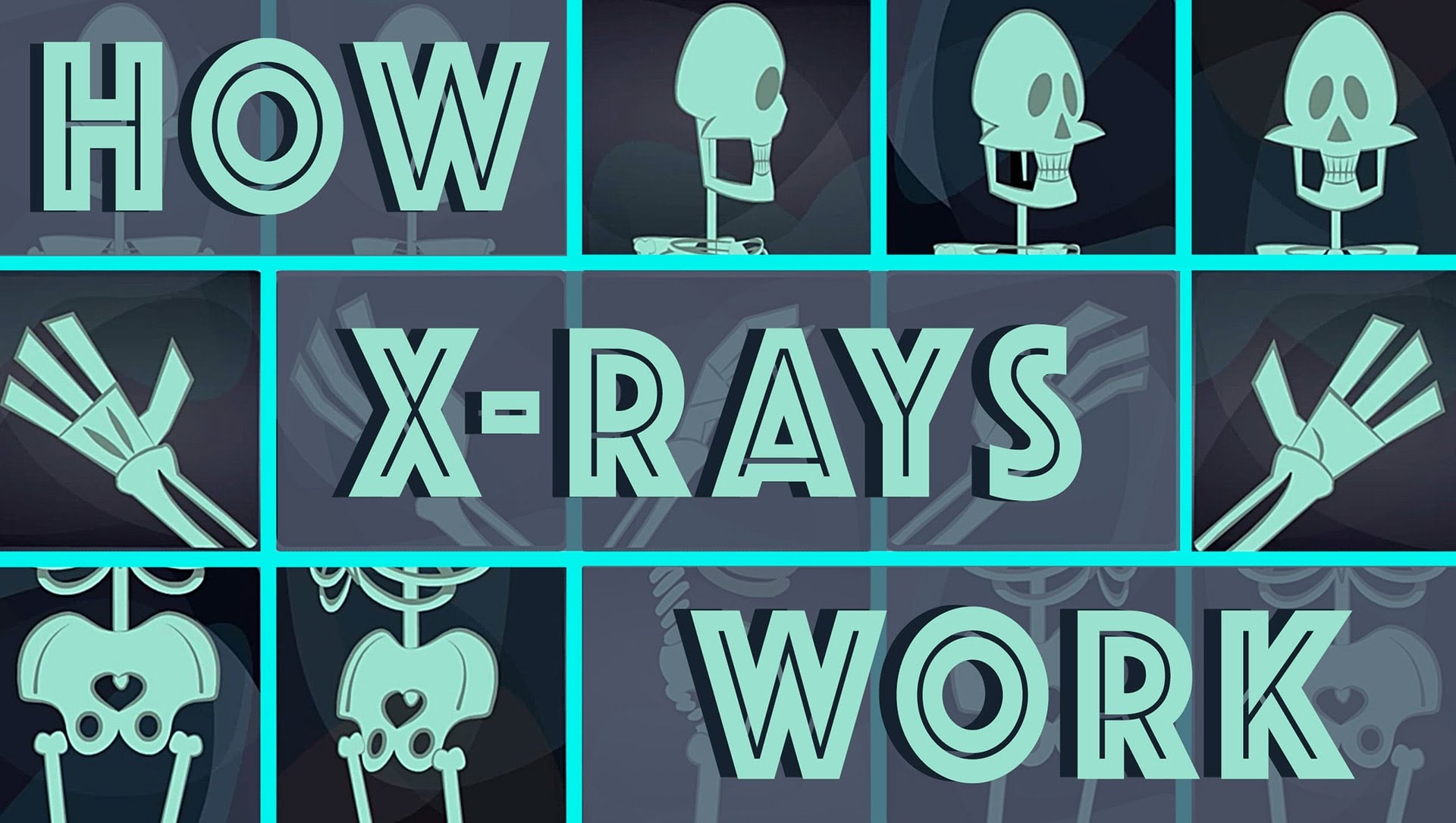 How do X-Rays Work?